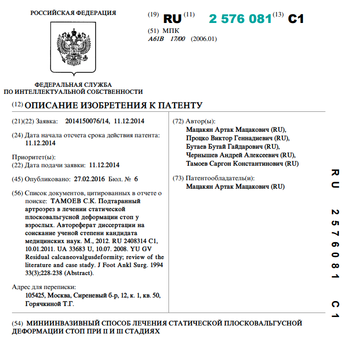 Миниинвазивный способ лечения статической плосковальгусной деформации стоп при II и III стадиях