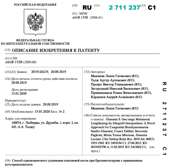 Способ одномоментного удлинения плюсневой кости при брахиметатарзии с применением аутотрансплантата