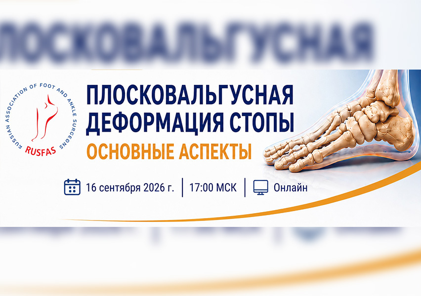 «Плосковальгусная деформации стопы» 16 сентября 2026 г.